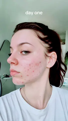 consistency with one product, rather than trying 10 different products at once.